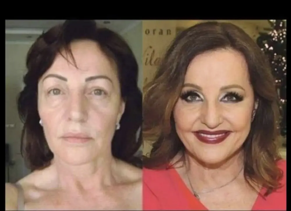 Ana Bekuta estetske operacije svet portal svet