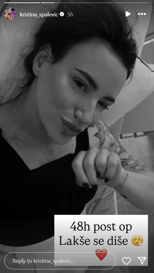 Operacija Kristine Spalević 